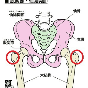 骨盤矯正で股関節の出っ張りが改善