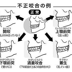 噛み合わせと自律神経について